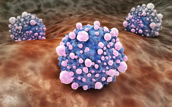Vista microscópica de células de un tumor de páncreas (Stocktrek Images - Getty)