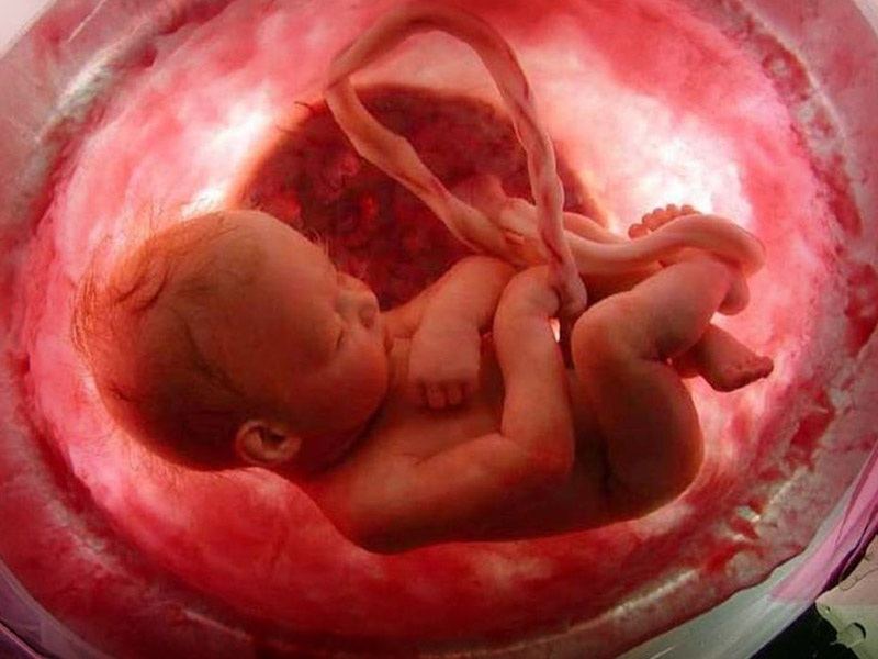 CUENTA LA UNAM CON PRIMERA UNIDAD DE CIRUGÍA FETAL EN MÉXICO