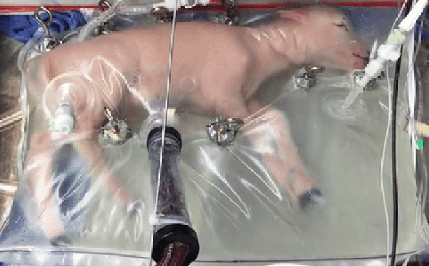 Un útero artificial permitirá reducir la mortalidad en bebés muy prematuros